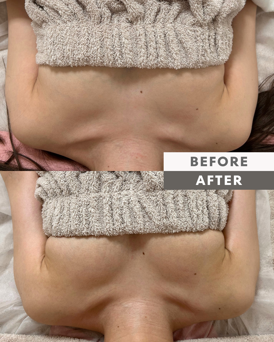 バストケア実績画像