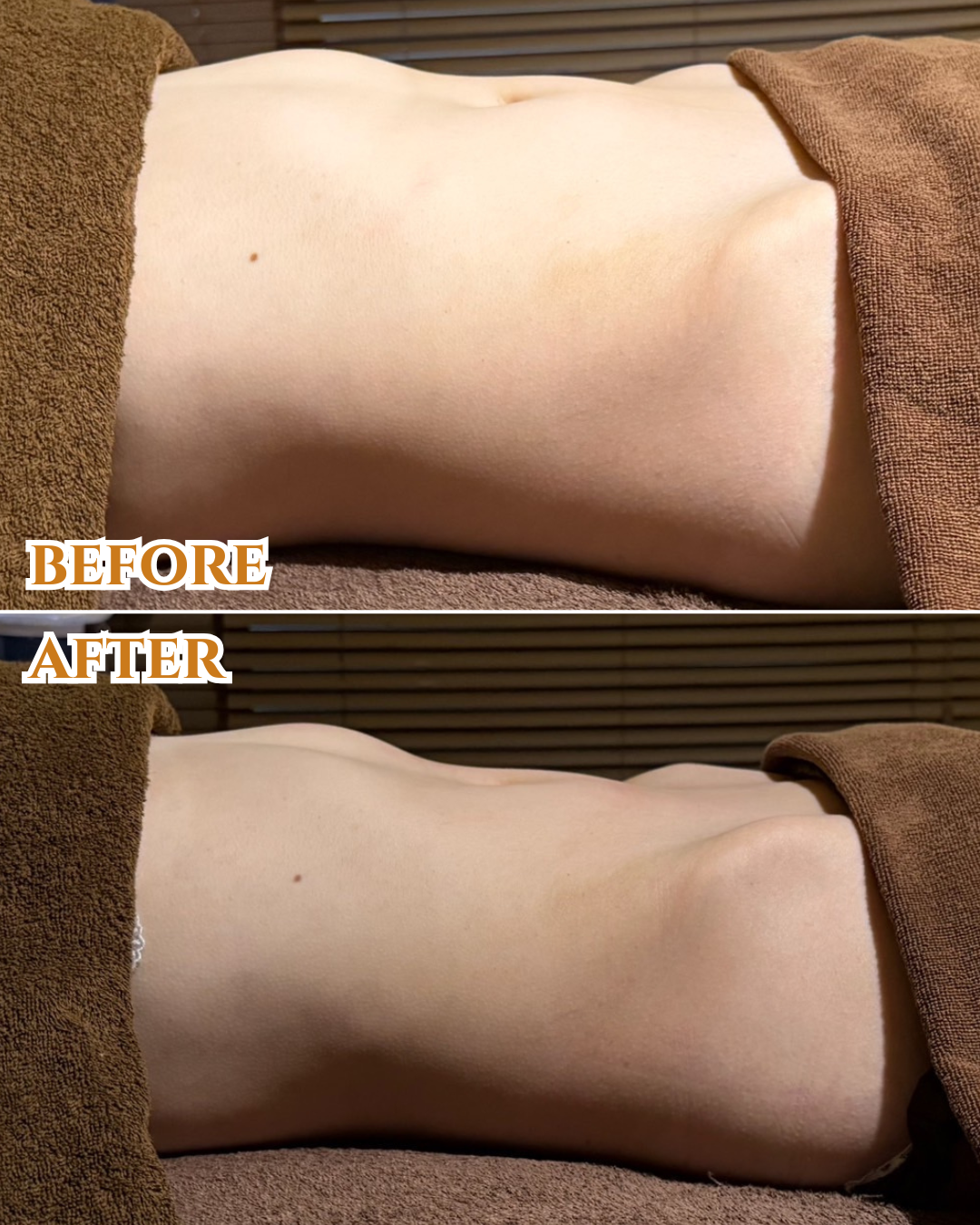 腸もみ実績画像